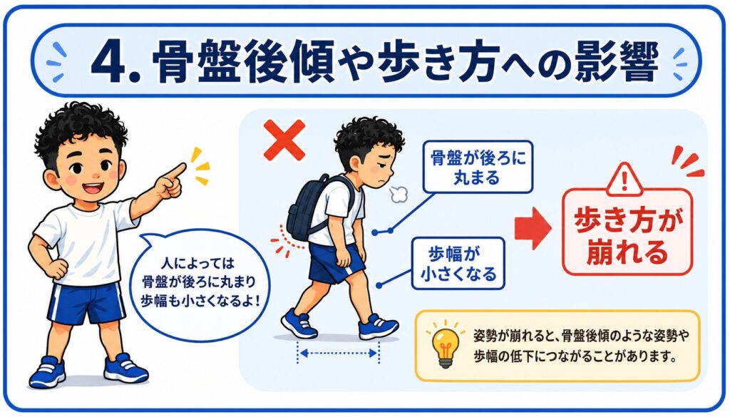 リュックの背負い方による骨盤後傾や歩き方への影響を、天満橋の姿勢改善ジムが解説するイラスト